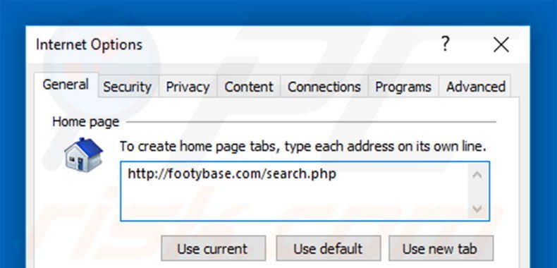 Eliminando footybase.com de la página de inicio de Internet Explorer